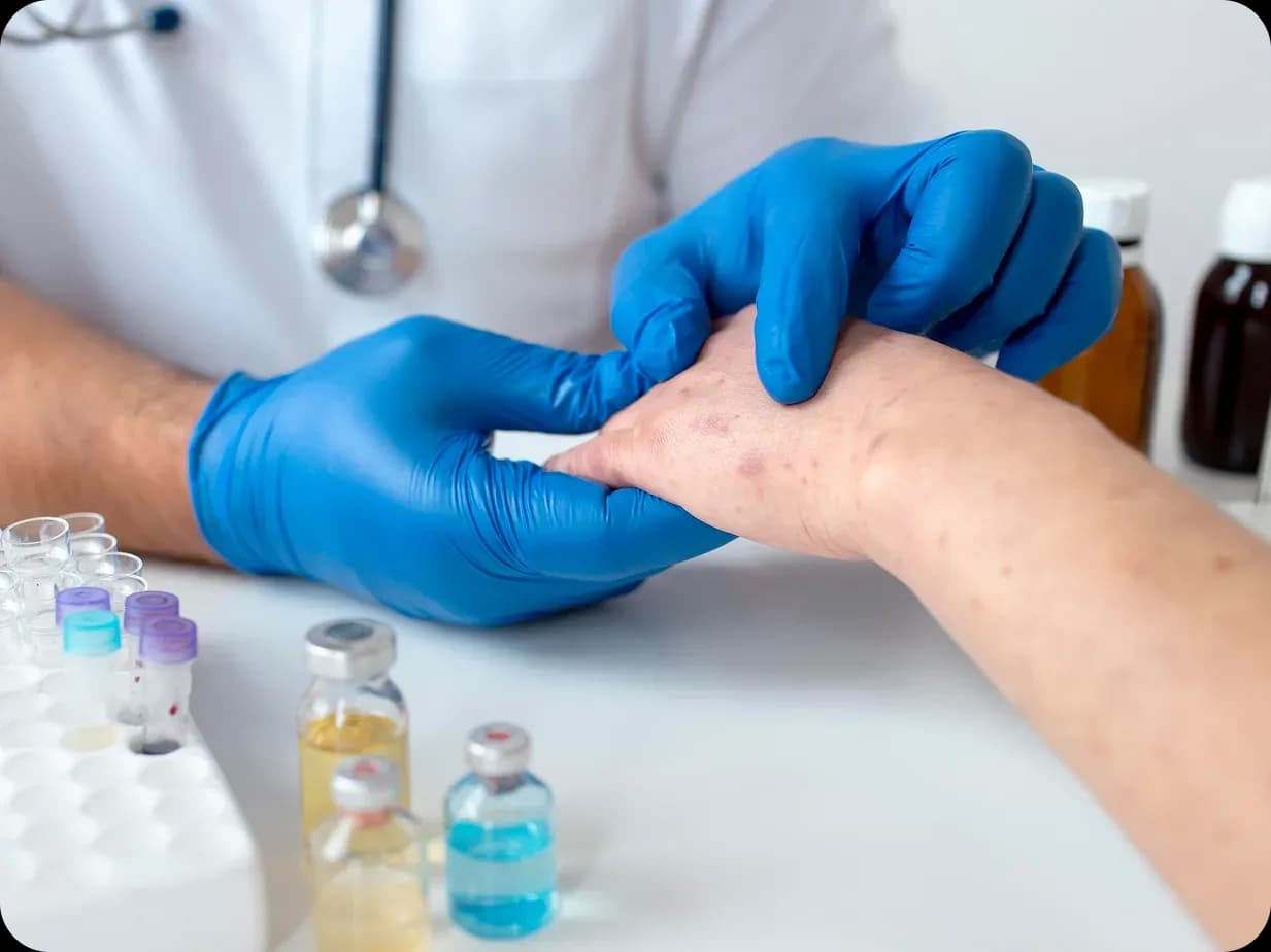 Antifungals