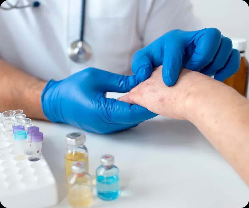Antifungals