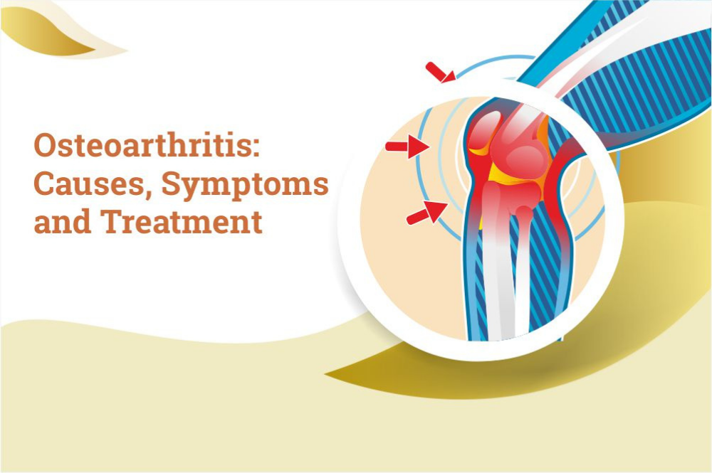 How is Osteoarthritis diagnosed? Understanding Osteoarthritis