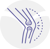 Rheumatoid Arthritis