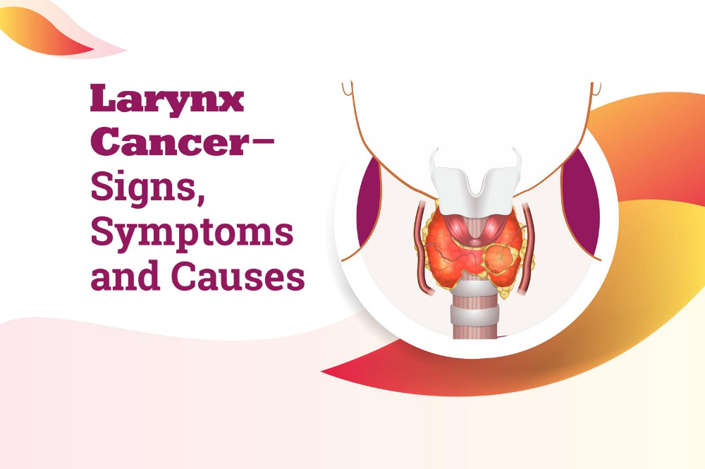 Early signs of Larynx cancer, its stages and symptoms