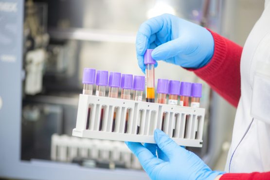 doctor hand taking a blood sample tube from a rack with machines of analysis in the lab background / Technician holding blood tube test in the research laboratory